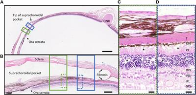 Chronic electrical stimulation with a peripheral suprachoroidal retinal implant: a preclinical safety study of neuroprotective stimulation
